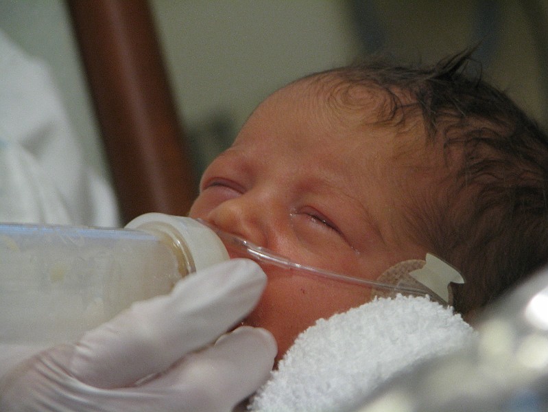 IMG_0404.JPG - The nurse had to feed me from a bottle.